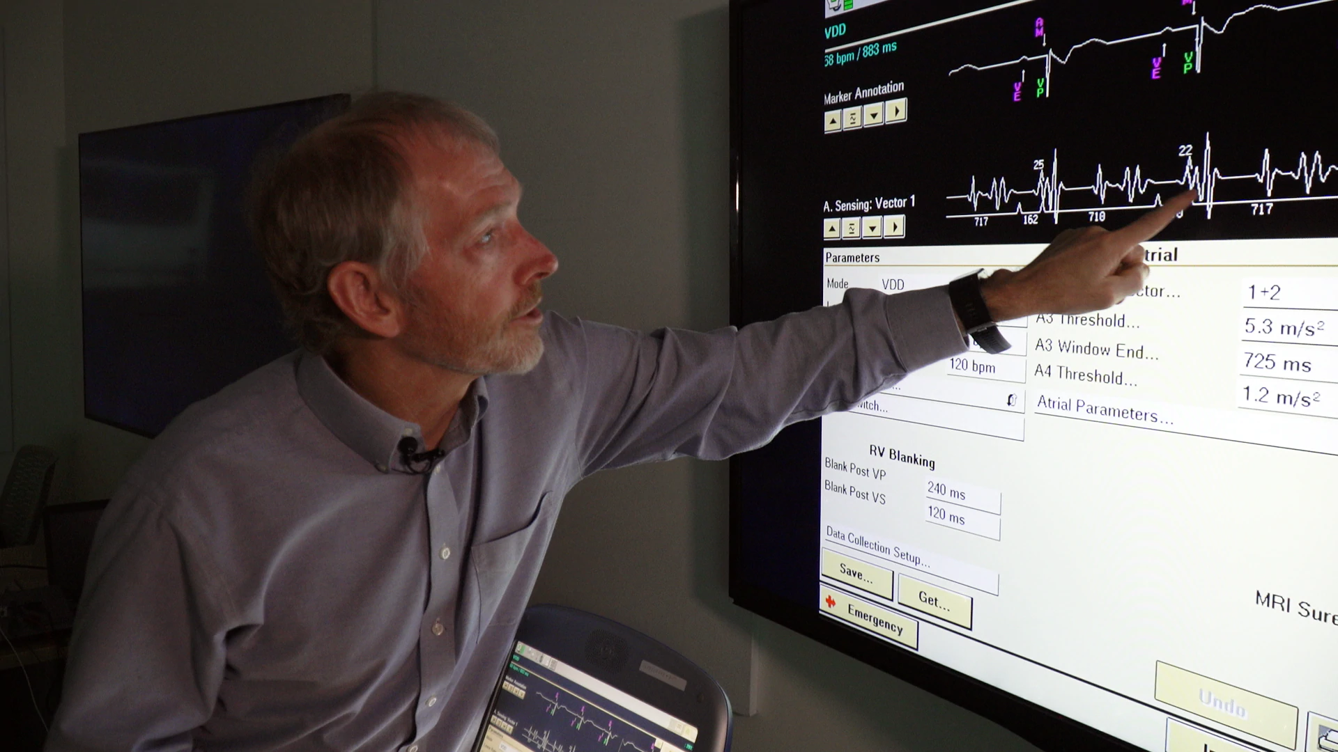 Medtronic Distinguished Scientist Todd Sheldon explains how Micra AV works.