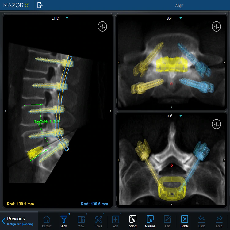 spine x-rays