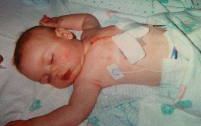 Jack as a baby, after open-heart surgery